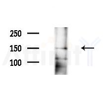 IBTK Antibody - Western blot analysis of extracts from A375 cells(heat-shock treatment), using IBTK Antibody at 1/1000 dilution.