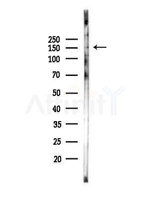IBTK Antibody - Western blot analysis of lysates from A375 cells(heat-shock,45min treatment), using IBTK Antibody at 1/1000 dilution.