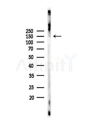 IBTK Antibody - Western blot analysis of lysates from Rat brain, using IBTK Antibody at 1/1000 dilution.