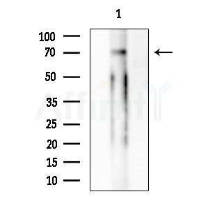 RBPJL Antibody - Western blot analysis of extracts from EC304 cells, using RBPJL Antibody at 1/1000 dilution.