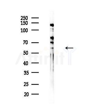 RBPJL Antibody - Western blot analysis of lysates from EC304 cells, using RBPJL Antibody at 1/1000 dilution.
