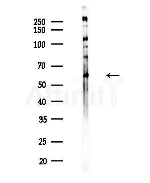 RBPJL Antibody - Western blot analysis of lysates from HUVEC cells, using RBPJL Antibody at 1/1000 dilution.