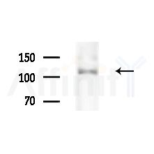 MKL2 Antibody - Western blot analysis of extracts from various samples, using MKL2 Antibody at 1/1000 dilution.