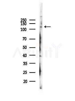 MKL2 Antibody - Western blot analysis of lysates from HepG2 cells(starvation,24h treatment), using MKL2 Antibody at 1/1000 dilution.