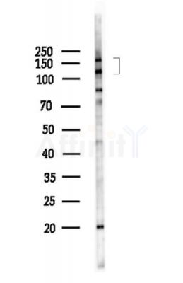 TRIM33 Antibody - Western blot analysis of lysates from LoVo cells(heat-shock,45min treatment), using TRIM33 Antibody at 1/1000 dilution.