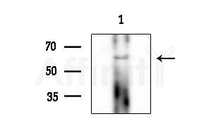 TRIM35 Antibody - Western blot analysis of extracts from EC304 cells, using TRIM35 Antibody at 1/1000 dilution.