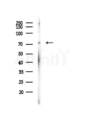 RNF6 Antibody - Western blot analysis of lysates from A375 cells(heat-shock, 45min treatment), using RNF6 Antibody at 1/1000 dilution.