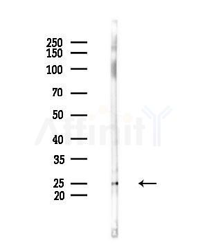 AK5 Antibody - Western blot analysis of lysates from COLO205 cells(heat-shock,45min treatment), using AK5 Antibody at 1/1000 dilution.