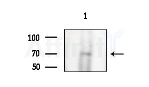 Collagen VIII  alpha 1 Antibody - Western blot analysis of extracts from HUVEC cells, using Collagen VIII  alpha 1 Antibody at 1/1000 dilution.