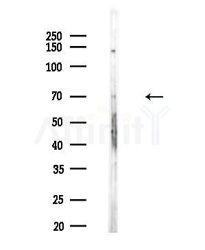 Collagen VIII  alpha 1 Antibody - Western blot analysis of lysates from HUVEC cells, using Collagen VIII  alpha 1 Antibody at 1/1000 dilution.