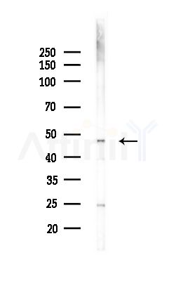 COX15 Antibody - Western blot analysis of lysates from Hela cells(heat-shock,45min treatment), using COX15 Antibody at 1/1000 dilution.