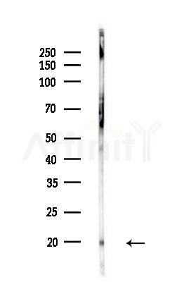 COX5B Antibody - Western blot analysis of lysates from Rat liver, using COX5B Antibody at 1/1000 dilution.