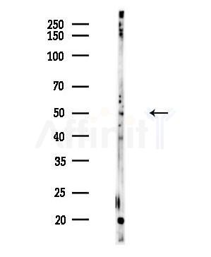 CDCA7L Antibody - Western blot analysis of lysates from HUVEC cells, using CDCA7L Antibody at 1/1000 dilution.
