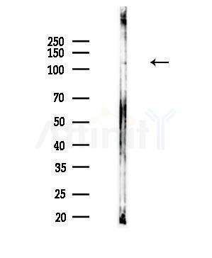 ADCY7 Antibody - Western blot analysis of lysates from EC304 cells, using ADCY7 Antibody at 1/1000 dilution.