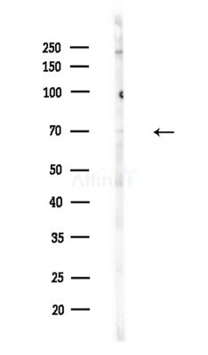 Cytochrome c Oxidase 1 Antibody - Western blot analysis of lysates from A375 cells(LPS,4h treatment), using Cytochrome c Oxidase 1 Antibody at 1/1000 dilution.