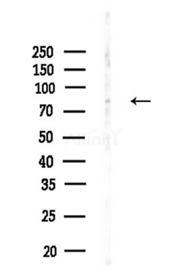Cytochrome c Oxidase 1 Antibody - Western blot analysis of lysates from Rat brain, using Cytochrome c Oxidase 1 Antibody at 1/1000 dilution.