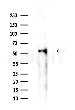 Cytochrome P450 4F8 Antibody - Western blot analysis of lysates from Rat lung, using Cytochrome P450 4F8 Antibody at 1/1000 dilution.