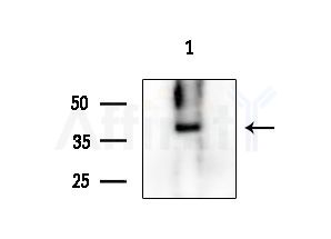 CRLF1 Antibody - Western blot analysis of extracts from HUVEC cells, using CRLF1 Antibody at 1/1000 dilution.