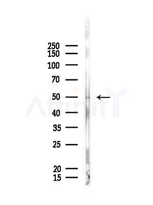 CRLF3 Antibody - Western blot analysis of lysates from Rat lung, using CRLF3 Antibody at 1/1000 dilution.