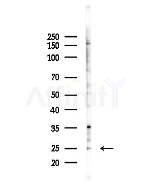Cytochrome c Oxidase 7A2 Antibody - Western blot analysis of lysates from Hela cells(LPS,4h treatment), using Cytochrome c Oxidase 7A2 Antibody at 1/1000 dilution.