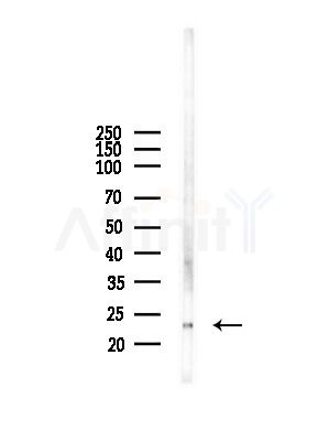DRD1IP Antibody - Western blot analysis of lysates from A375 cells(starvation,24h treatment), using DRD1IP Antibody at 1/1000 dilution.