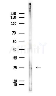 FGF11 Antibody - Western blot analysis of lysates from Mouse lung, using FGF11 Antibody at 1/1000 dilution.