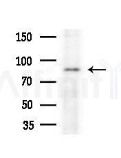 GTSE1 Antibody - Western blot analysis of extracts from Rat brain, using GTSE1 Antibody at 1/1000 dilution.