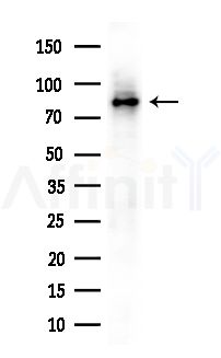 GTSE1 Antibody - Western blot analysis of extracts from B16F10-LUC cells(UV,30min treatment), using GTSE1 Antibody at 1/1000 dilution.