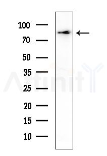 GTSE1 Antibody - Western blot analysis of extracts from Raji cells(heat-shock,45min treatment), using GTSE1 Antibody at 1/1000 dilution.