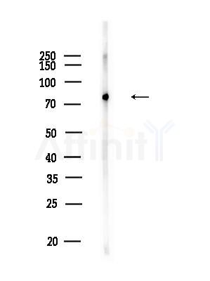 GTSE1 Antibody - Western blot analysis of lysates from Raji cells(heat-shock,45min treatment), using GTSE1 Antibody at 1/1000 dilution.