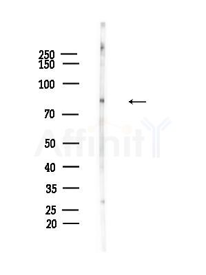 GTSE1 Antibody - Western blot analysis of lysates from Rat brain, using GTSE1 Antibody at 1/1000 dilution.