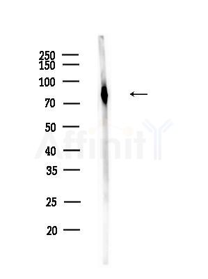 GTSE1 Antibody - Western blot analysis of lysates from B16F10-LUC cells(UV,30min treatment), using GTSE1 Antibody at 1/1000 dilution.