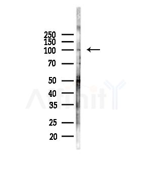 HSP74 Antibody - Western blot analysis of lysates from COLO205 cells(heat-shock,45min treatment), using HSP74 Antibody at 1/1000 dilution.