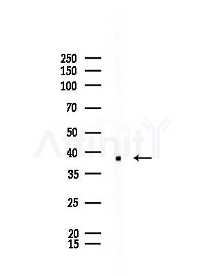 IL10RB Antibody - Western blot analysis of lysates from Rat brain, using IL10RB Antibody at 1/1000 dilution.