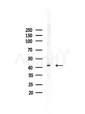 IL10RB Antibody - Western blot analysis of lysates from PC12 cells(LPS, 4h treatment), using IL10RB Antibody at 1/1000 dilution.