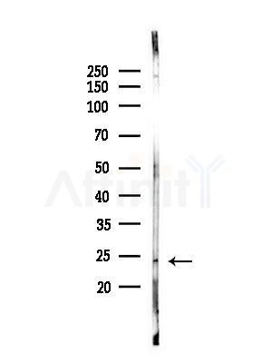 IFN14 Antibody - Western blot analysis of lysates from A375 cells(heat-shock,45min treatment), using IFN14 Antibody at 1/1000 dilution.