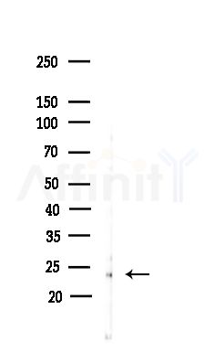 IFN17 Antibody - Western blot analysis of lysates from COLO205 cells(heat-shock,45min treatment), using IFN17 Antibody at 1/1000 dilution.