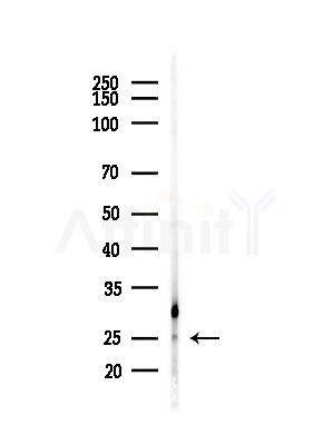 IFN21 Antibody - Western blot analysis of lysates from B16F10-LUC cells(starvation,24h treatment), using IFN21 Antibody at 1/1000 dilution.