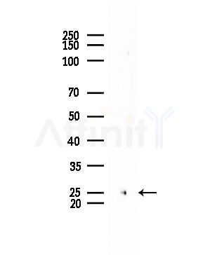 IFNA5 Antibody - Western blot analysis of lysates from Mouse brain, using IFNA5 Antibody at 1/1000 dilution.