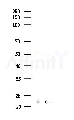 IFNA6 Antibody - Western blot analysis of lysates from B16F10-LUC cells(starvation,24h treatment), using IFNA6 Antibody at 1/1000 dilution.