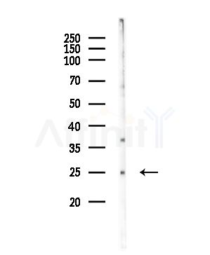 IFNK Antibody - Western blot analysis of lysates from COLO205 cells, using IFNK Antibody at 1/1000 dilution.