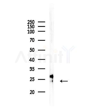 IL17B Antibody - Western blot analysis of lysates from COLO205 cells, using IL17B Antibody at 1/1000 dilution.