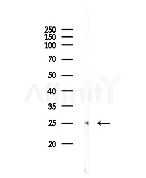 IL17C Antibody - Western blot analysis of lysates from COLO205 cells, using IL17C Antibody at 1/1000 dilution.