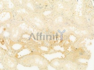 IL17C Antibody - DF8980 at 1/100 staining human normal kidney tissue by IHC-P.