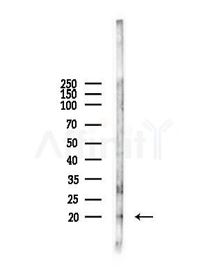 IL17F Antibody - Western blot analysis of lysates from A375 cells(starvation,24h treatment), using IL17F Antibody at 1/1000 dilution.