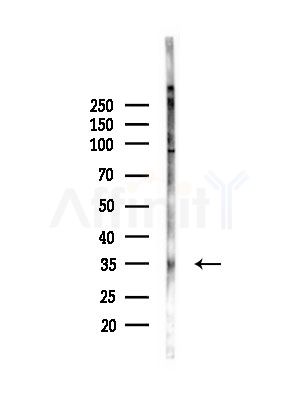 IL31 Antibody - Western blot analysis of lysates from PC12 cells(LPS, 4h treatment), using IL31 Antibody at 1/1000 dilution.