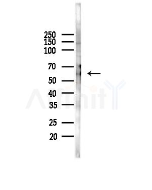 ILRL2 Antibody - Western blot analysis of lysates from COLO205 cells(heat-shock,45min treatment), using ILRL2 Antibody at 1/1000 dilution.