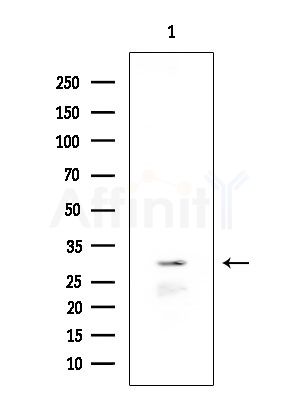INSIG2 Antibody - Western blot analysis of extracts from B16F10-LUC cells(starvation treatment), using INSIG2 Antibody at 1/1000 dilution.
