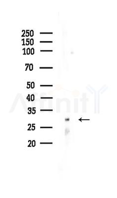 INSIG2 Antibody - Western blot analysis of lysates from B16F10-LUC cells(starvation treatment), using INSIG2 Antibody at 1/1000 dilution.