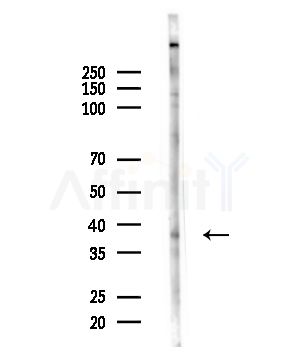 ITBP2 Antibody - Western blot analysis of lysates from COLO205 cells(heat-shock,45min treatment), using ITBP2 Antibody at 1/1000 dilution.